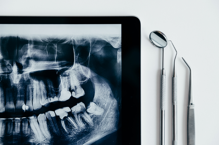 Dental-X-Ray.png