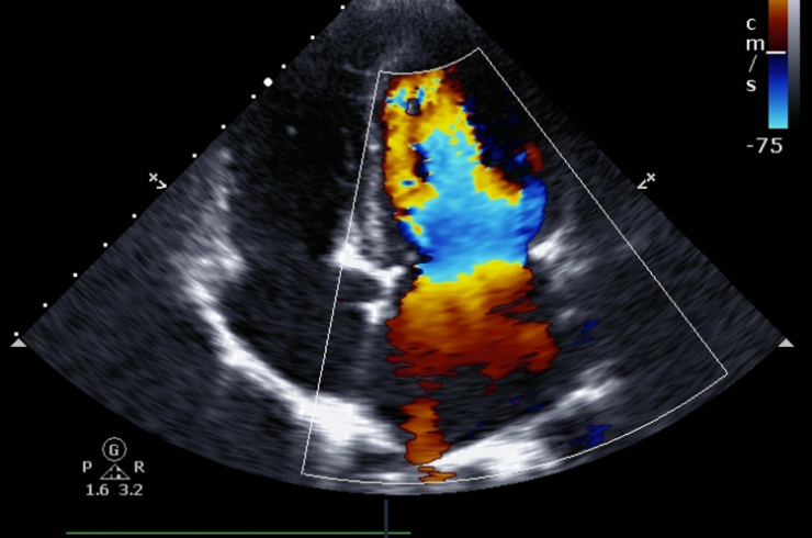 Doppler-Ultrasound.png