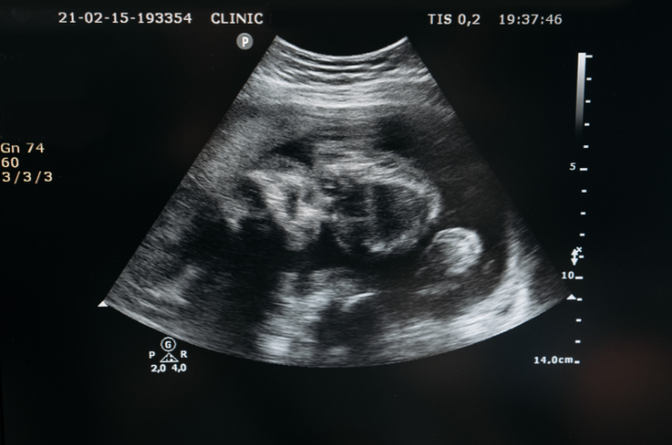 Obstetric-Ultrasound.png
