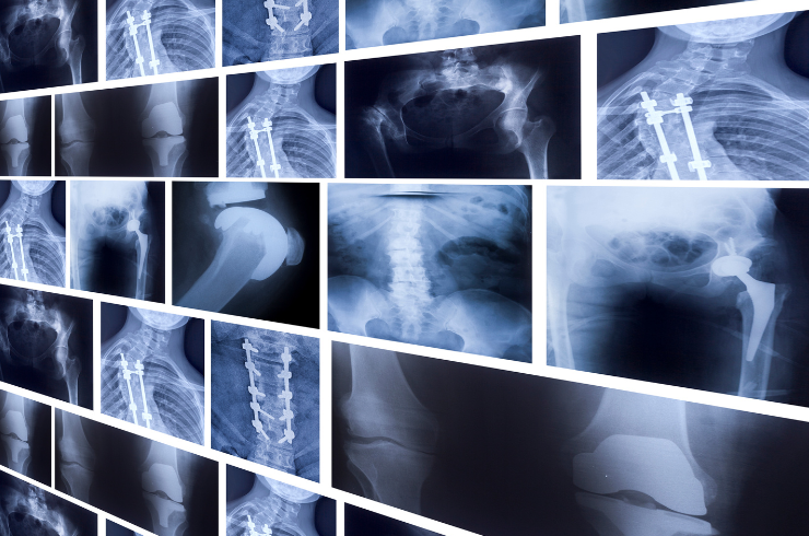 X-Ray-Imaging.png